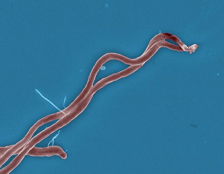 File:SESOTT174 Image2.jpg